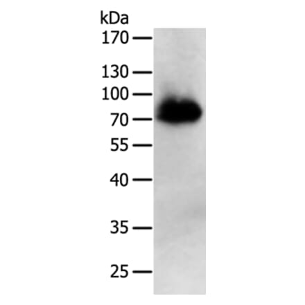 PRMT7 Antibodies | Antibodies.com