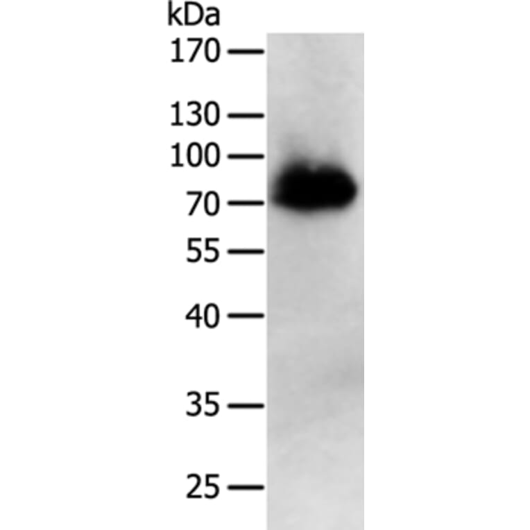 PRMT7 Antibody from Signalway Antibody (35889) - Antibodies.com