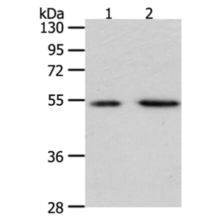 PSMD5 Antibody from Signalway Antibody (35896) - Antibodies.com