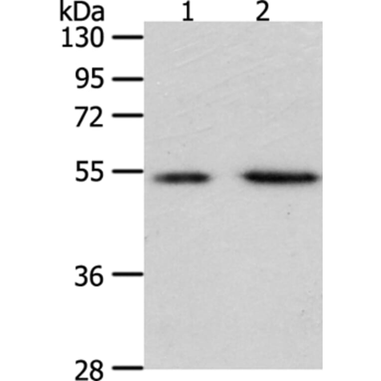 PSMD5 Antibody from Signalway Antibody (35896) - Antibodies.com