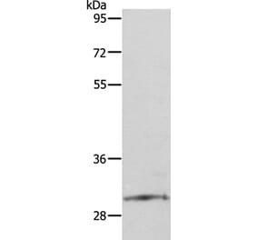 SNAI2 Antibody from Signalway Antibody (35919) - Antibodies.com