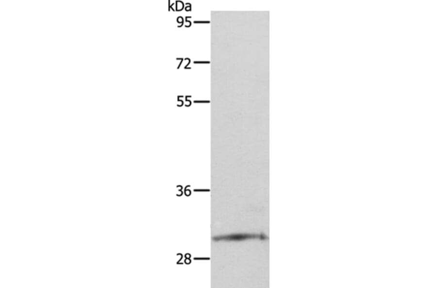SNAI2 Antibody from Signalway Antibody (35919) - Antibodies.com