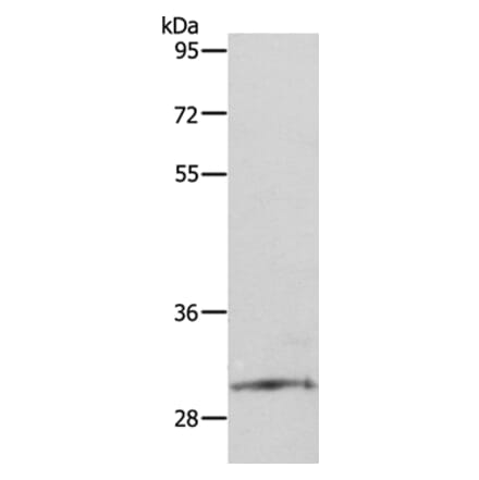 SNAI2 Antibody from Signalway Antibody (35919) - Antibodies.com