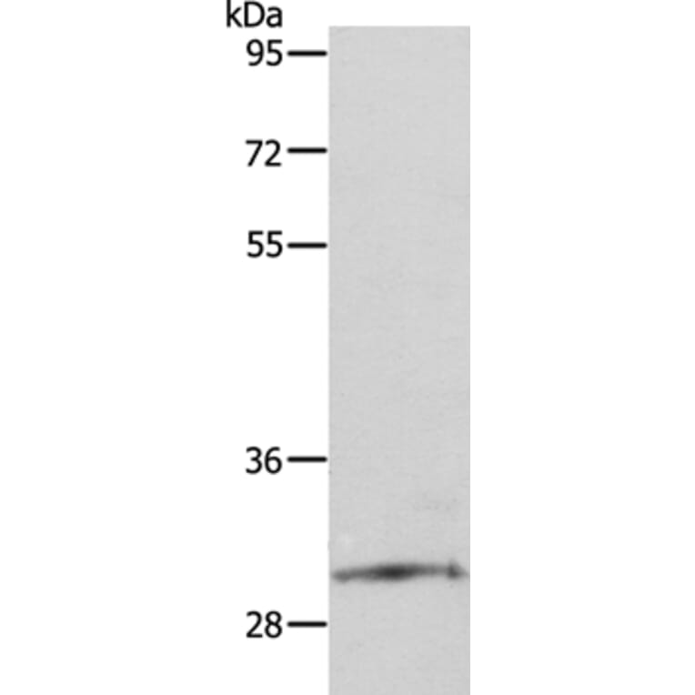 SNAI2 Antibody from Signalway Antibody (35919) - Antibodies.com