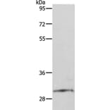 SNAI2 Antibody from Signalway Antibody (35919) - Antibodies.com