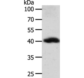 WNT9A Antibody from Signalway Antibody (35983) - Antibodies.com