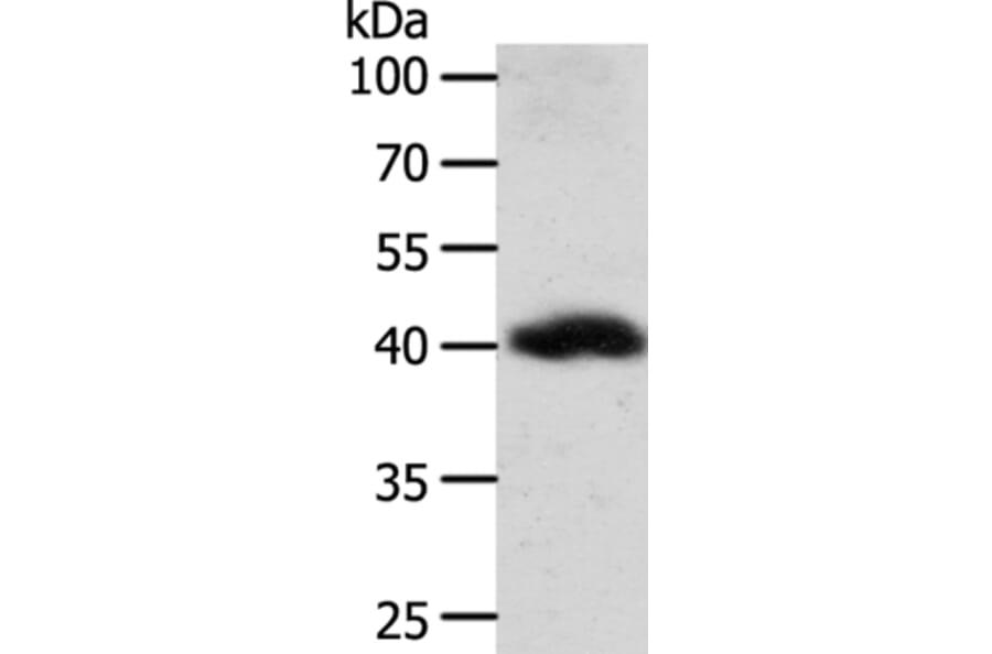 WNT9A Antibody from Signalway Antibody (35983) - Antibodies.com