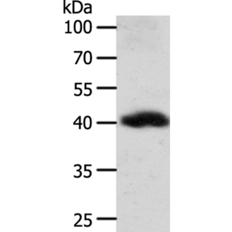 WNT9A Antibody from Signalway Antibody (35983) - Antibodies.com
