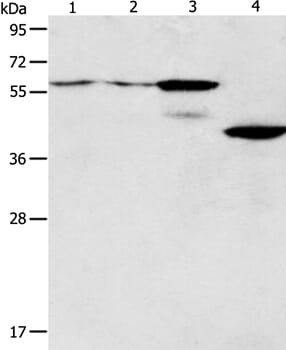 Gel: 10% SDS-PAGE Lysates (from left to right): A375 and A172 cell, mouse pancreas tissue, human liver cancer tissue Amount of lysate: 40ug per lane Primary antibody: 1/550 dilution Secondary antibody dilution: 1/8000 Exposure time: 20 seconds