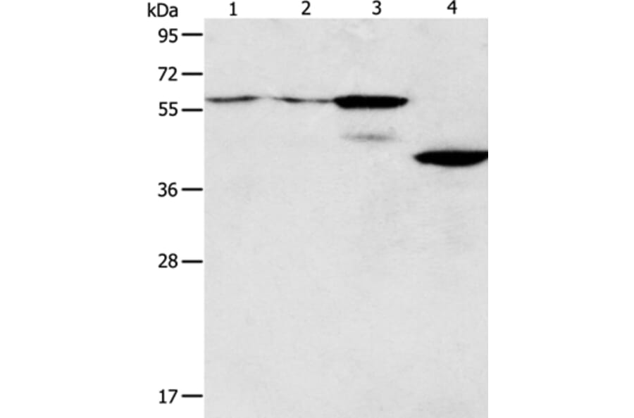 PGBD2 Antibody from Signalway Antibody (35996) - Antibodies.com