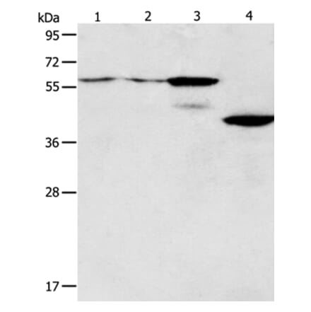 PGBD2 Antibody from Signalway Antibody (35996) - Antibodies.com