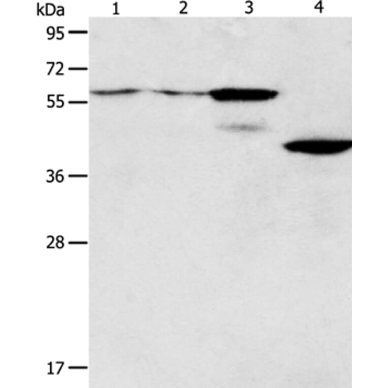 PGBD2 Antibody from Signalway Antibody (35996) - Antibodies.com