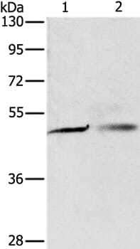 Gel: 8% SDS-PAGE Lysates (from left to right): A549 and A375 cell Amount of lysate: 40ug per lane Primary antibody: 1/250 dilution Secondary antibody dilution: 1/8000 Exposure time: 5 seconds