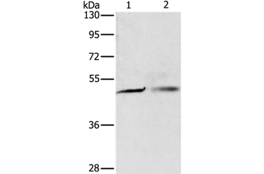 PGBD4 Antibody from Signalway Antibody (35997) - Antibodies.com