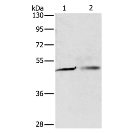 PGBD4 Antibody from Signalway Antibody (35997) - Antibodies.com