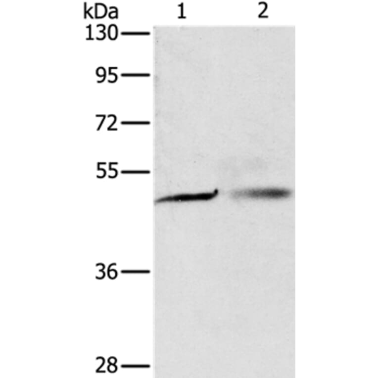 PGBD4 Antibody from Signalway Antibody (35997) - Antibodies.com