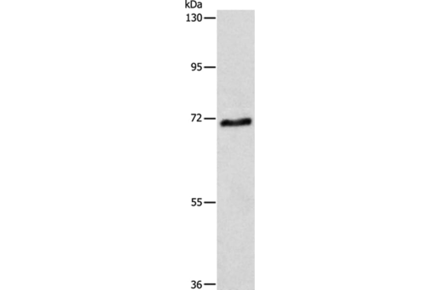 ABCG4 Antibody from Signalway Antibody (36006) - Antibodies.com