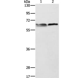 ALAS2 Antibody from Signalway Antibody (36074) - Antibodies.com