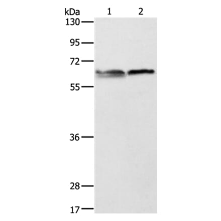 ALAS2 Antibody from Signalway Antibody (36074) - Antibodies.com