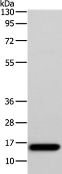 Gel: 15+12% SDS-PAGE Lysates (from left to right): Human fetal muscle tissue Amount of lysate: 40ug per lane Primary antibody: 1/250 dilution Secondary antibody dilution: 1/8000 Exposure time: 1 minute