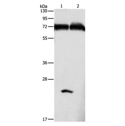 GDPD5 Antibody from Signalway Antibody (36148) - Antibodies.com