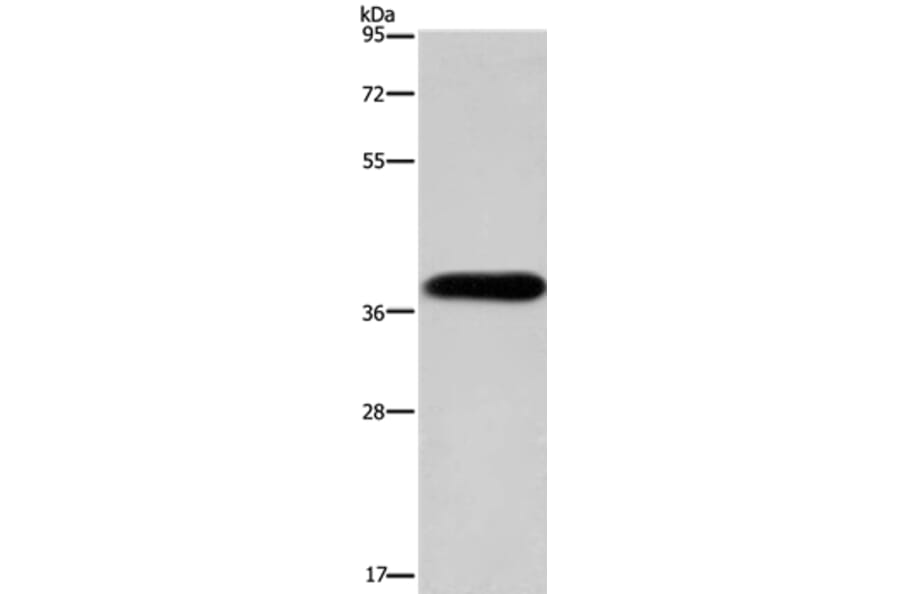 PITX2 Antibody from Signalway Antibody (36185) - Antibodies.com