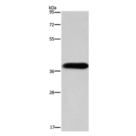 PITX2 Antibody from Signalway Antibody (36185) - Antibodies.com