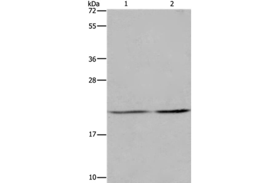 ASF1A Antibody from Signalway Antibody (36244) - Antibodies.com