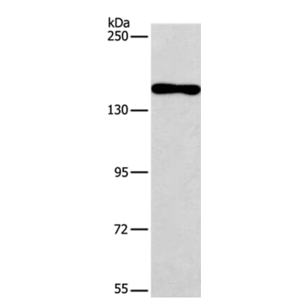 PDS5B Antibody from Signalway Antibody (36260) - Antibodies.com