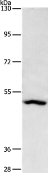 Gel: 8% SDS-PAGE Lysate: 40ug A431 cell Primary antibody: 1/1650 dilution Secondary antibody dilution: 1/8000 Exposure time: 2 minutes