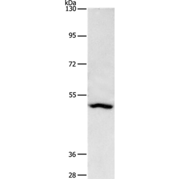 ASB10 Antibody from Signalway Antibody (36265) - Antibodies.com