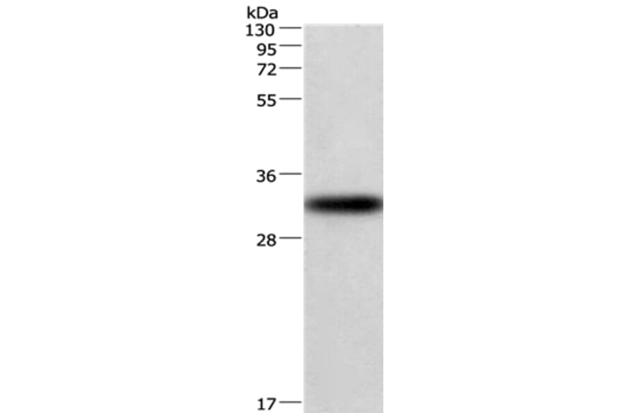 CENPP Antibody from Signalway Antibody (36340) - Antibodies.com