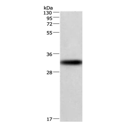 CENPP Antibody from Signalway Antibody (36340) - Antibodies.com