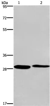 Gel: 8% SDS-PAGE Lysates (from left to right): Hela and 293T cell Amount of lysate: 40ug per lane Primary antibody: 1/400 dilution Secondary antibody dilution: 1/8000 Exposure time: 2 minutes