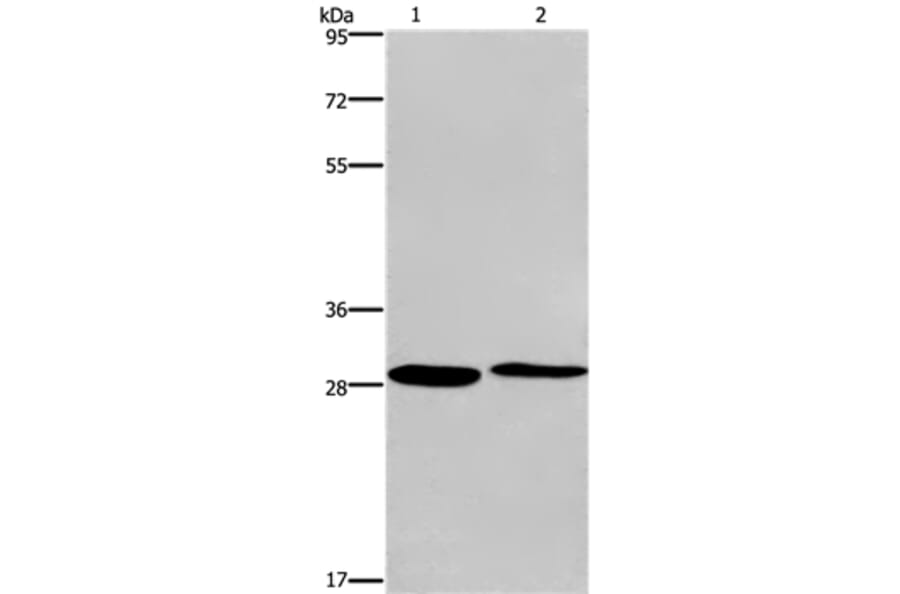 CPSF4 Antibody from Signalway Antibody (36367) - Antibodies.com
