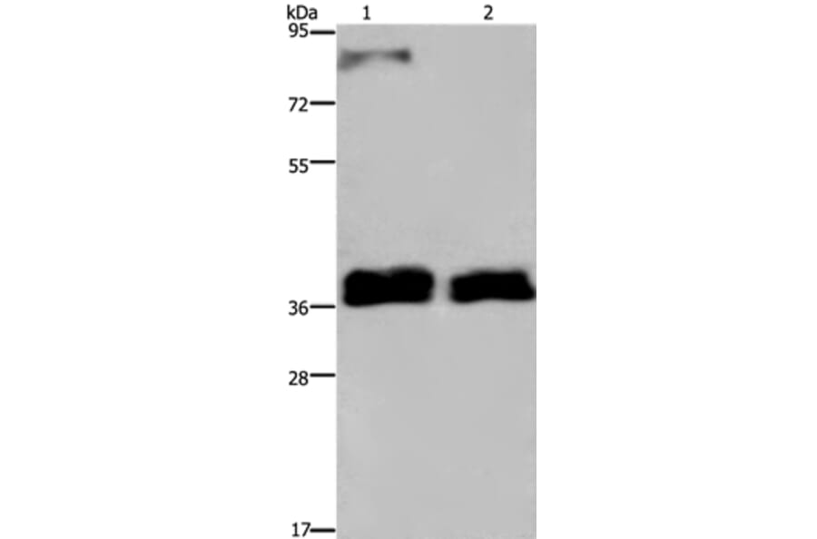 FETUB Antibody from Signalway Antibody (36475) - Antibodies.com