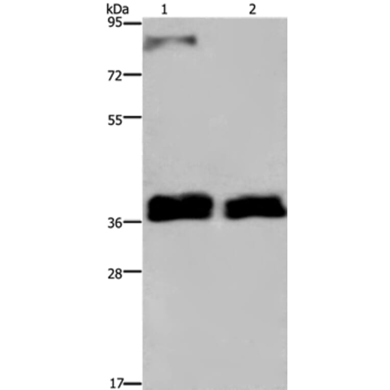 FETUB Antibody from Signalway Antibody (36475) - Antibodies.com