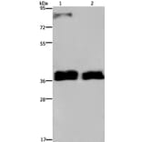 FETUB Antibody from Signalway Antibody (36475) - Antibodies.com