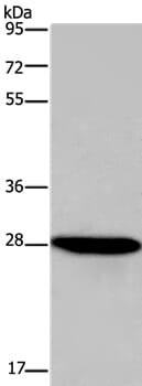 Gel: 8% SDS-PAGE Lysate: 40ug HepG2 cell Primary antibody: 1/600 dilution Secondary antibody dilution: 1/8000 Exposure time: 5 seconds
