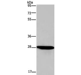 FGF17 Antibody from Signalway Antibody (36476) - Antibodies.com