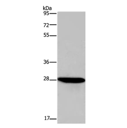 FGF17 Antibody from Signalway Antibody (36476) - Antibodies.com