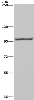 Gel: 6%SDS-PAGE Lysate: 40ug Raji cell Primary antibody: 1/650 dilution Secondary antibody dilution: 1/8000 Exposure time: 20 seconds