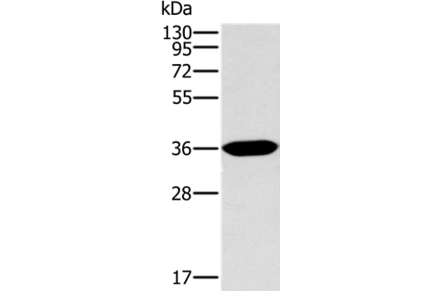 ITLN1 Antibody from Signalway Antibody (36560) - Antibodies.com