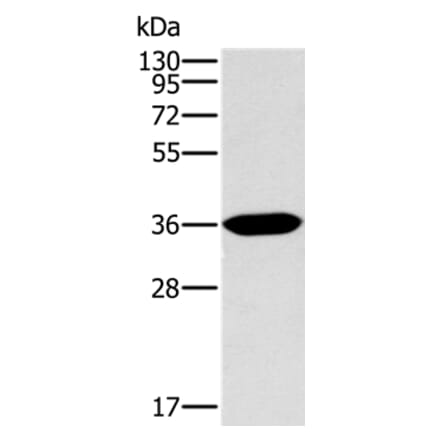 ITLN1 Antibody from Signalway Antibody (36560) - Antibodies.com