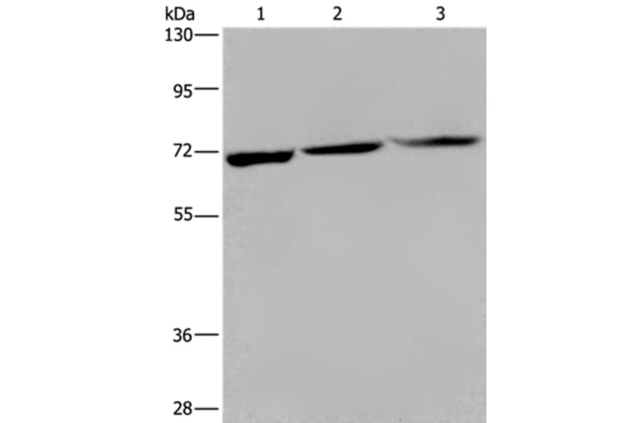 KLHL1 Antibody from Signalway Antibody (36572) - Antibodies.com