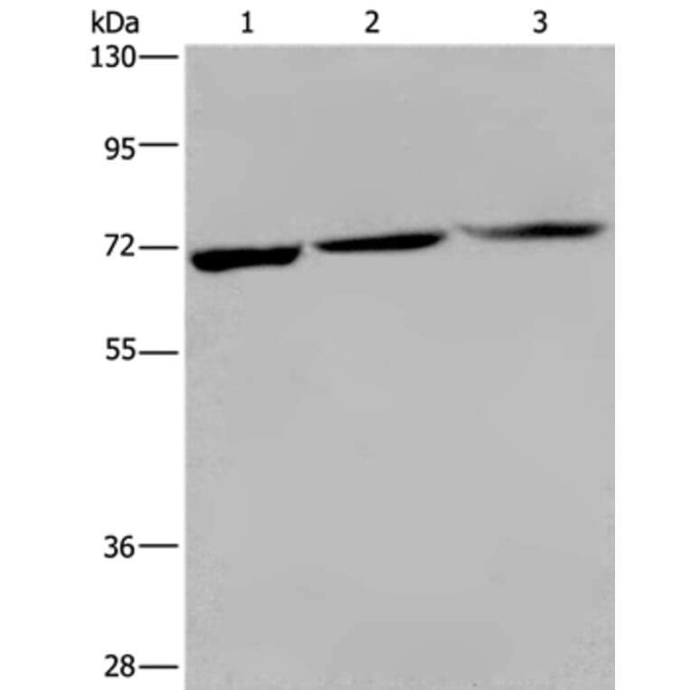 KLHL1 Antibody from Signalway Antibody (36572) - Antibodies.com