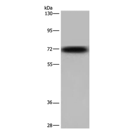 KCND3 Antibody from Signalway Antibody (36580) - Antibodies.com