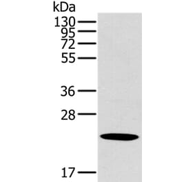 OTUB2 Antibody from Signalway Antibody (36671) - Antibodies.com