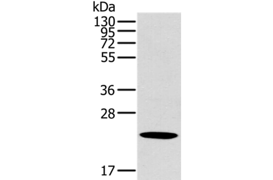 OTUB2 Antibody from Signalway Antibody (36671) - Antibodies.com