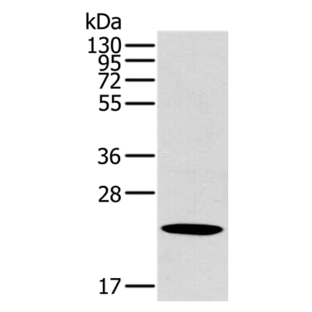 OTUB2 Antibody from Signalway Antibody (36671) - Antibodies.com